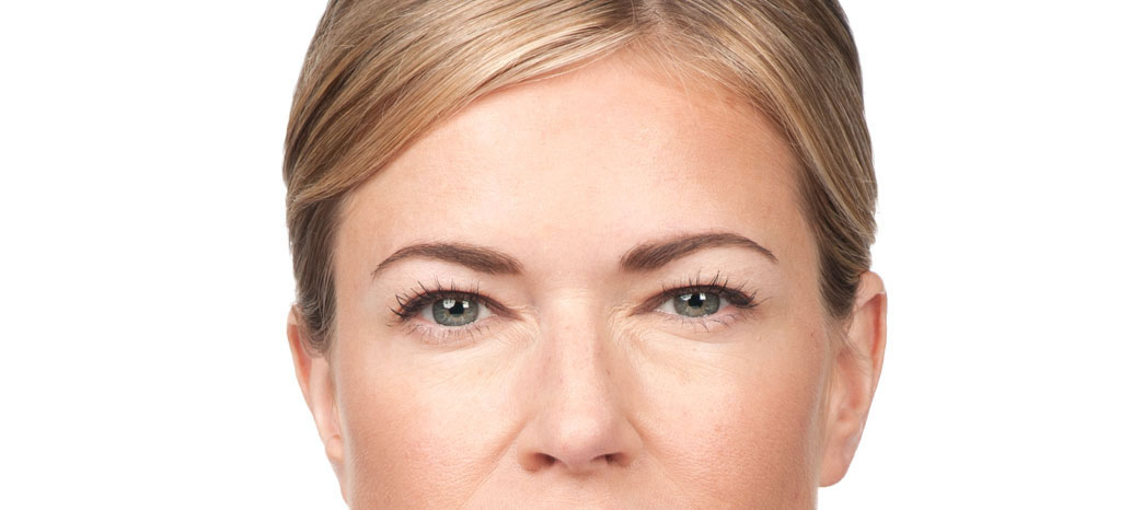 After-Anti Wrinkle